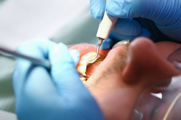 Best Pediatric Emergency Dentist in Rouse, CA