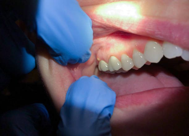 Best Cosmetic Emergency Dentistry in Rouse, CA