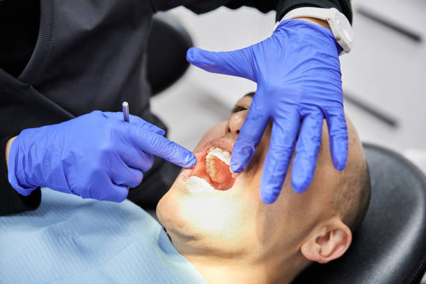 Best After-Hours Dental Trauma Care in Rouse, CA